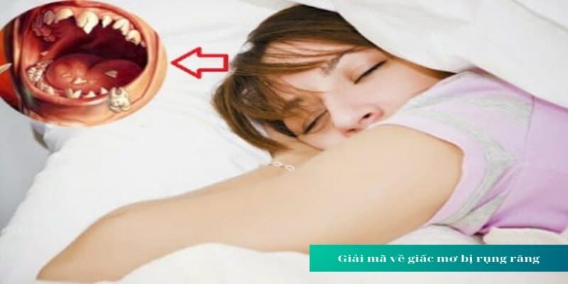 Nằm mơ thấy rụng răng đánh số mấy cực chuẩn